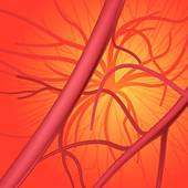 Complications vasculaires des affections hématologiques