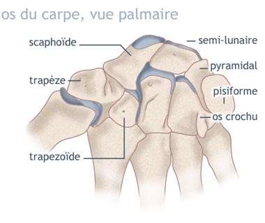 Fractures des os du carpe
