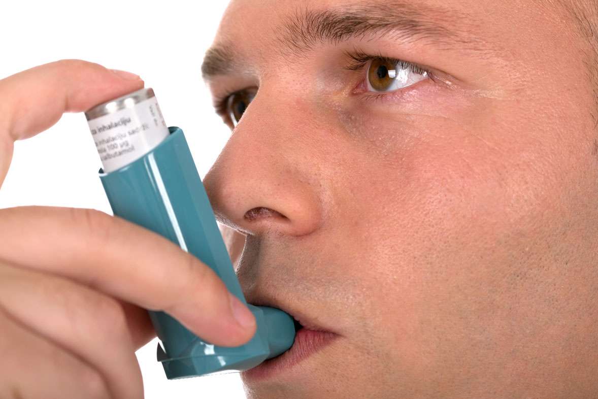 Facteurs environnementaux de l’asthme sévère et de l’allergie