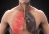 Anatomie pathologique des cancers bronchopulmonaires (Suite)