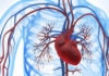 Cardiopathie coronarienne