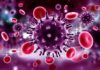 Manifestations dermatologiques de l’infection par le virus de l’immunodéficience humaine