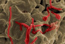 Fièvre hémorragique à virus Ebola