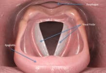 Anatomie descriptive, endoscopique et radiologique du larynx (Suite)