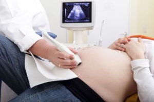 Hémorragie du premier trimestre de grossesse