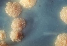 Bactériologie de la tuberculose et des infections à mycobactéries atypiques