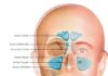 Explorations physiques et fonctionnelles des fosses nasales (Suite)