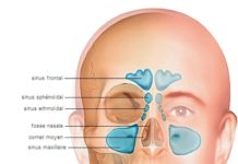 Explorations physiques et fonctionnelles des fosses nasales (Suite)