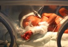 Détresse respiratoire du nouveau-né
