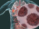 Cancers épidermoïdes et adénocarcinomes bronchiques