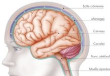 Radiothérapie des tumeurs cérébrales primitives de l’adulte