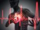 Soins IDE aux patients atteints d'infarctus du myocarde