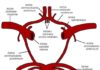 Syndromes anatomocliniques des infarctus du territoire de l’artère carotide