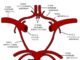 Syndromes anatomocliniques des infarctus du territoire de l’artère carotide