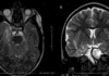 Nouvelles techniques IRM du parenchyme cérébral