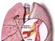 Tomodensitométrie spiralée dans le diagnostic de l’embolie pulmonaire aiguë