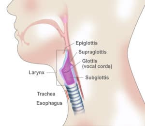 Traumatismes externes du larynx (Suite)